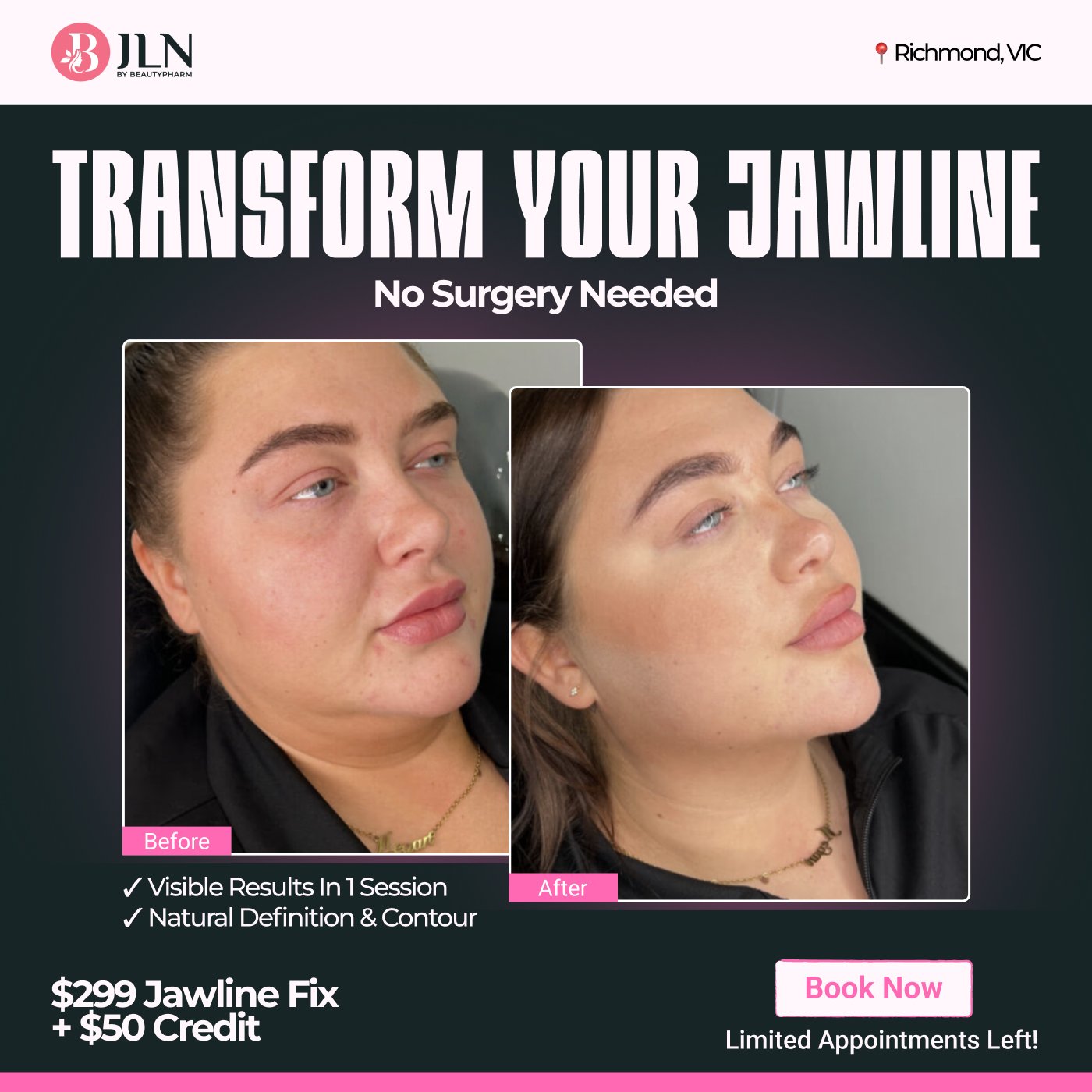 Beauty before and after post